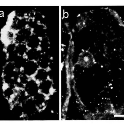 Chloroplast anchoring refers to the observation that